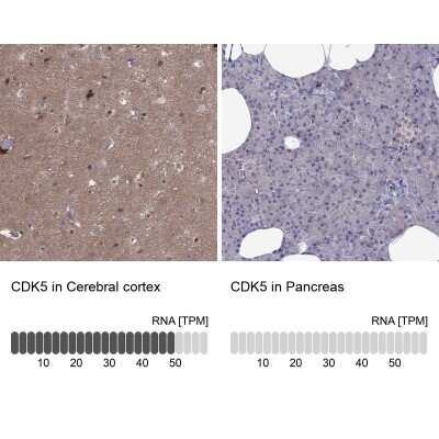 Immunohistochemistry-Paraffin: Cdk5 Antibody [NBP2-55870]