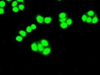 Immunocytochemistry/ Immunofluorescence: Cdk5 Antibody (OTI2H6) - Azide and BSA Free [NBP2-70396]