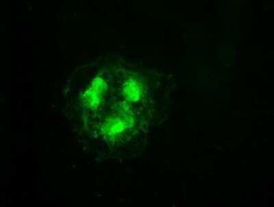 Immunocytochemistry/ Immunofluorescence: Cdk5 Antibody (OTI2H6) - Azide and BSA Free [NBP2-70396]