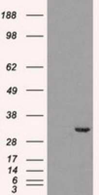 Western Blot: Cdk5 Antibody (OTI2H6)Azide and BSA Free [NBP2-70396]