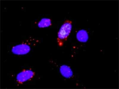 Proximity Ligation Assay: Cdk6 Antibody (8H4) [H00001021-M01]