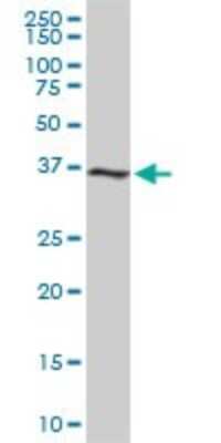 Western Blot: Cdk6 Antibody (8H4) [H00001021-M01]