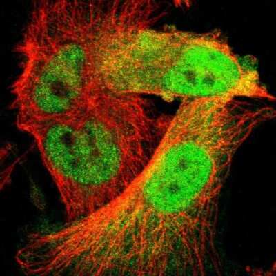 Immunocytochemistry/ Immunofluorescence: Cdk6 Antibody [NBP1-87262]