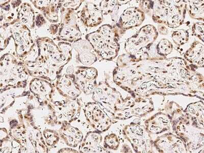 Immunohistochemistry-Paraffin: Cdk6 Antibody [NBP2-98990]