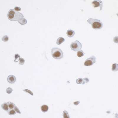Immunocytochemistry: Cdk7 Antibody (BL-80-5D4) [NBP2-76409]