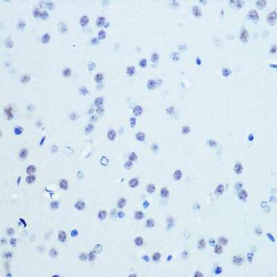 Immunohistochemistry-Paraffin: Cdk9 Antibody (1C4E3) [NBP3-15345]