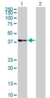 Western Blot: Cdk9 Antibody (2D7) [H00001025-M07]