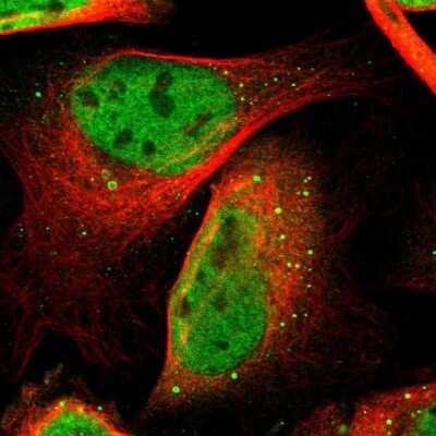 Immunocytochemistry/ Immunofluorescence: Cdk9 Antibody [NBP1-86808]