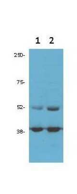Western Blot: Cdk9 Antibody [NB120-10874]