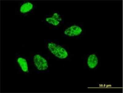 Immunocytochemistry/ Immunofluorescence: Cdx1 Antibody (2D8) [H00001044-M01]