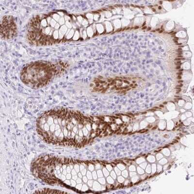 Immunohistochemistry-Paraffin: Cdx1 Antibody [NBP2-49173]