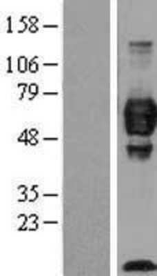Western Blot: IGSF4C/SynCAM4 Overexpression Lysate [NBL1-08639]