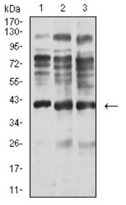 Western Blot: Centaurin alpha 1 Antibody (3E2D9)BSA Free [NBP2-61732]