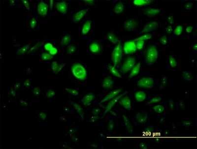 Immunocytochemistry/ Immunofluorescence: Centaurin alpha 1 Antibody [H00011033-B01P]