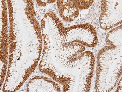 Immunohistochemistry-Paraffin: Centaurin alpha 1 Antibody [NBP1-31179]