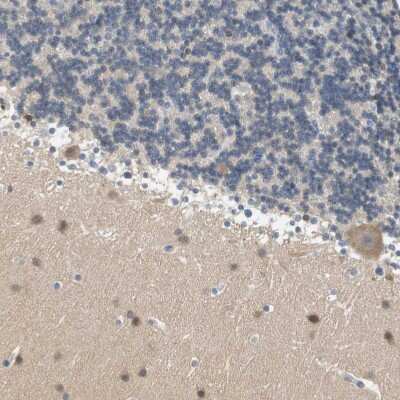 Immunohistochemistry-Paraffin: Centaurin alpha 1 Antibody [NBP1-88097]