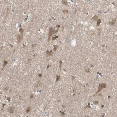 Immunohistochemistry-Paraffin: Centaurin alpha 1 Antibody [NBP1-88097]