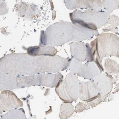 Immunohistochemistry-Paraffin: Centaurin alpha 1 Antibody [NBP1-88097]