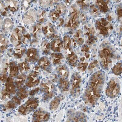 Immunohistochemistry-Paraffin: Centaurin alpha 1 Antibody [NBP1-88097]