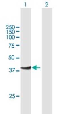 Western Blot: Centaurin alpha 1 Antibody [H00011033-B01P]