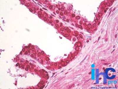 Immunohistochemistry-Paraffin: Centaurin beta 2 Antibody [NBP2-24528]
