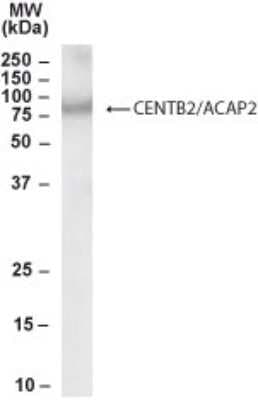 Western Blot: Centaurin beta 2 Antibody [NB100-1321]