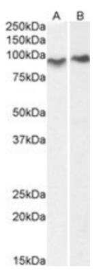 Western Blot: Centaurin beta 2 Antibody [NB100-1321]
