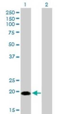 Western Blot: Centrin 1 Antibody (2A6) [H00001068-M01]