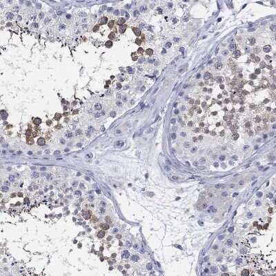 Immunohistochemistry-Paraffin: Centrin 1 Antibody [NBP3-17028]