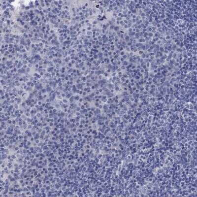 Immunohistochemistry-Paraffin: Centrin 1 Antibody [NBP3-17028]