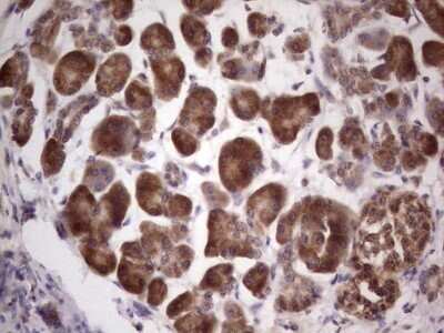 Immunohistochemistry: Centrin 1 Antibody (OTI1E1) - Azide and BSA Free [NBP2-70408]