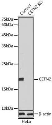 Knockout Validated: Centrin 2 Antibody - Azide and BSA Free [NBP2-92653]