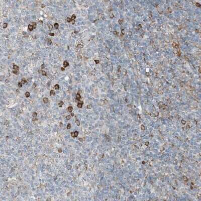 Immunohistochemistry-Paraffin: Ceramide Kinase Like Antibody [NBP1-87115]