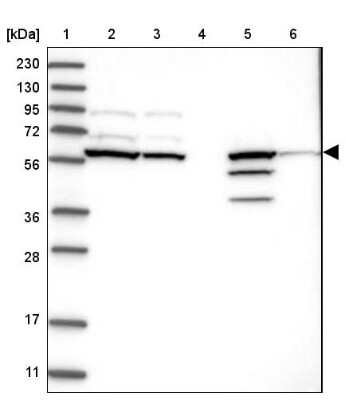 Western Blot: Ceramide Kinase Like Antibody [NBP1-87115]