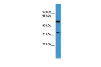 Western Blot: Ceramide Kinase Like Antibody [NBP2-87178]