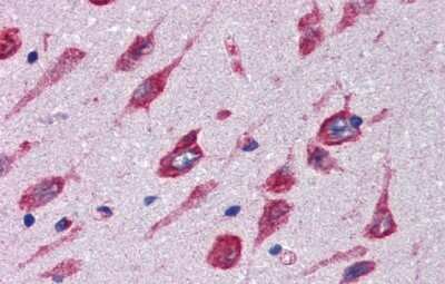 Immunohistochemistry: Cerebellin-4 Antibody [NBP2-84664]