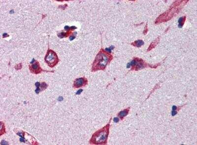 Immunohistochemistry: Cerebellin-4 Antibody [NBP2-84664]