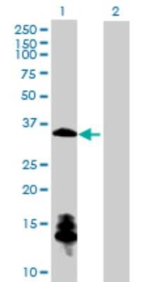 Western Blot: ChGn Antibody [H00055790-B01P]