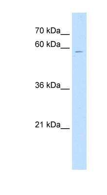 Western Blot: ChGn Antibody [NBP1-59218]