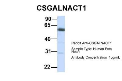 Western Blot: ChGn Antibody [NBP1-59219]