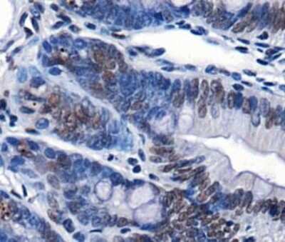 Immunohistochemistry: CHD7 Antibody - BSA Free [NBP1-77393]