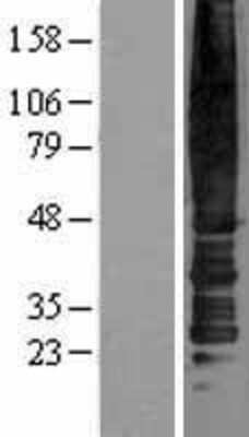Western Blot: CC Chemokine Receptor D6 Overexpression Lysate [NBL1-08759]