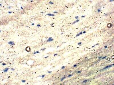 Immunohistochemistry-Paraffin: Chimaerin 2 Antibody [NBP3-12294]