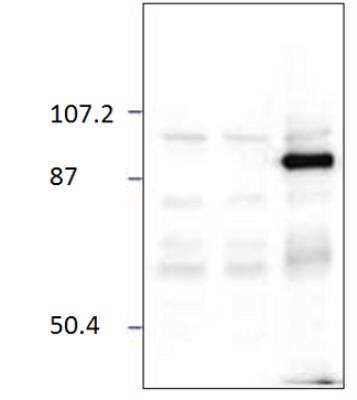 Western Blot: Chimaerin 2 Antibody [NBP3-12460]
