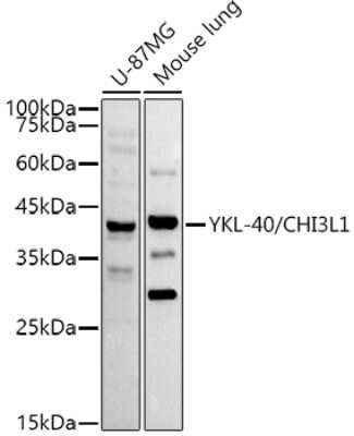 Western Blot: Chitinase 3-like 1/YKL-40 Antibody (7T1R3) [NBP3-16077]