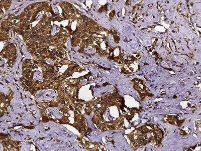 Immunohistochemistry-Paraffin: Chitinase 3-like 2 Antibody (213) [NBP2-90064]