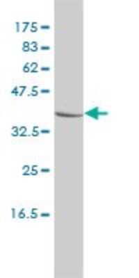 Western Blot: Chitobiase/CTBS Antibody (1B5-1B9) [H00001486-M01]