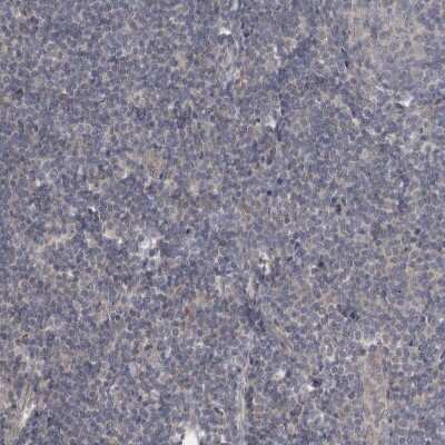 Immunohistochemistry-Paraffin: Chitobiase/CTBS Antibody [NBP1-85388]