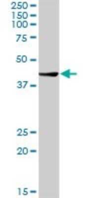 Western Blot: Chitobiase/CTBS Antibody [H00001486-D01P]