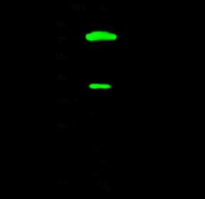 Western Blot: Chitobiase/CTBS Antibody [NBP2-99190]